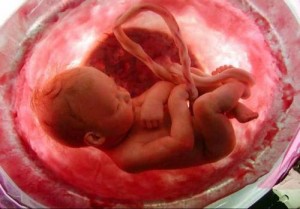 feto-9-meses